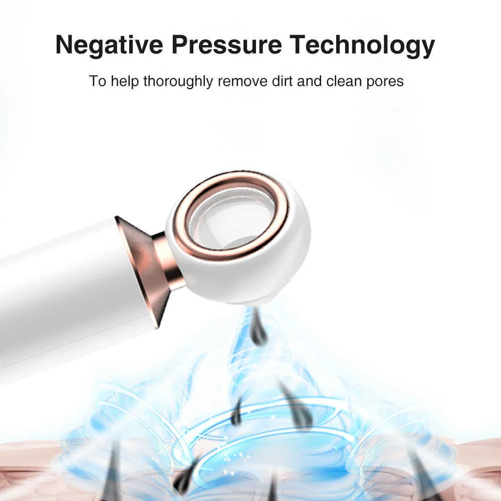 Souqely™ Blackhead Suction Machine