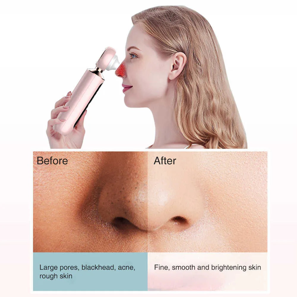 Souqely™ Blackhead Suction Machine