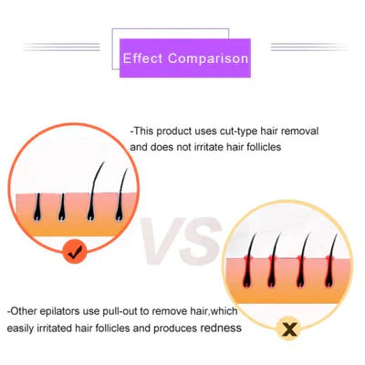 Souqely™Purple Epilator – آلة إزالة الشعر البنفسجية