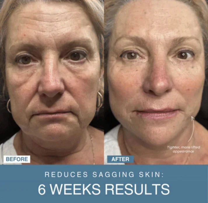 Souqely™ 7-in-1 LED Anti-Aging/Wrinkle Apparatus