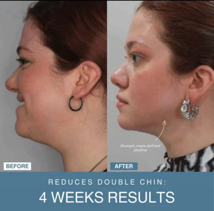 Souqely™ 7-in-1 LED Anti-Aging/Wrinkle Apparatus