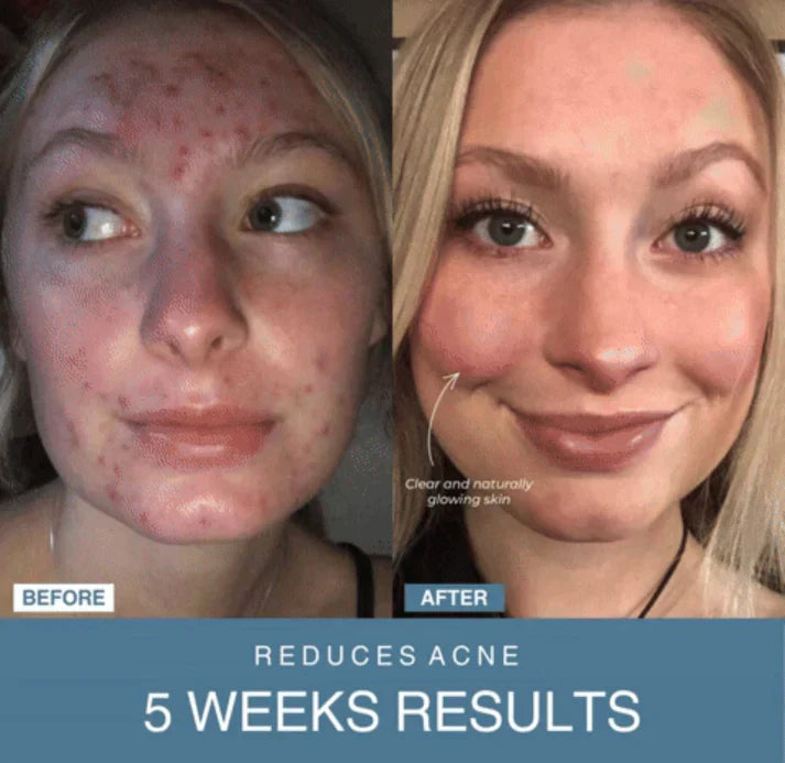 Souqely™ 7-in-1 LED Anti-Aging/Wrinkle Apparatus