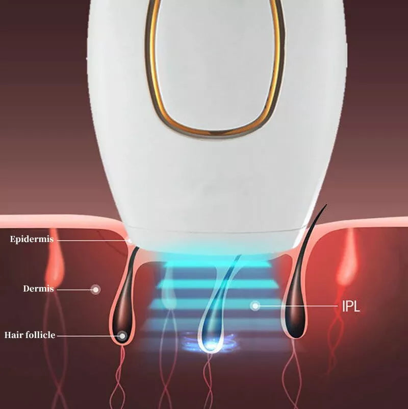 Souqely™ IPL Laser Hair Removal – جهاز إزالة الشعر بالليزر IPL
